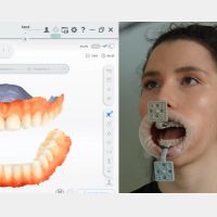 MetiSmile-MR Tracker und Marker