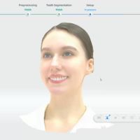 MetiSmile Gesichtsanalyse und Kieferorthopädie-Simulation